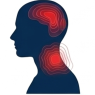 Cervicogenic Heaadaches
