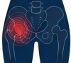 Hip Pain