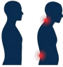 Postural Issues