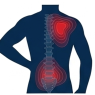 Upper-lowerback pain