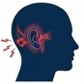 Vestibular